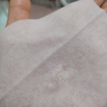 Molfix Islak Mendilde Plastik Parça Çıktı, Bebek Sağlığı Tehlikede