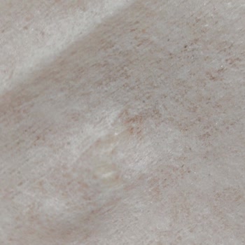 Molfix Islak Mendilde Plastik Parça Çıktı, Bebek Sağlığı Tehlikede