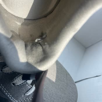 Ayakkabının İç Astarı Yırtıldı, Ayak Yaralandı; Mağaza Fotoğrafla İnceleme Yapıp Kusur Yok Dedi