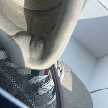 Ayakkabının İç Astarı Yırtıldı, Ayak Yaralandı; Mağaza Fotoğrafla İnceleme Yapıp Kusur Yok Dedi