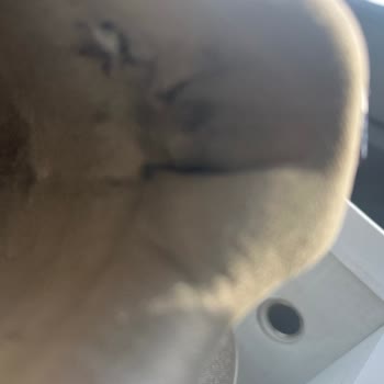 Ayakkabının İç Astarı Yırtıldı, Ayak Yaralandı; Mağaza Fotoğrafla İnceleme Yapıp Kusur Yok Dedi