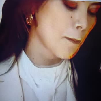 Kırmızı Gölgelendirme Sorunu Nedeniyle Onvo Televizyonun Değişim Ve İade Talebi