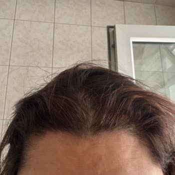 Saç Rengi Yanlış Çıktı Personel Tutumu Olumsuz Ve Ek Kart Ücreti İade Talebi