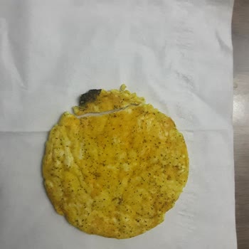 Eti Gong Ürününün Üzerindeki Siyah Leke Sağlık Ve Güven Sorunu