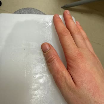 Komili Ayçiçeği Yağının Patlaması Ve Hastane Tedavisi