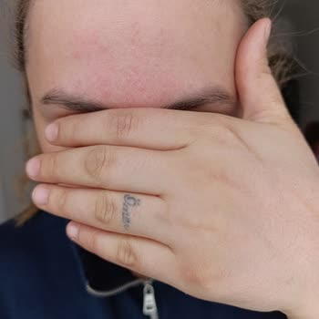 Cilt Reaksiyonu Ve Müşteri Hizmetleri Yanıtı Olmadan Ürün İadesi Talebi