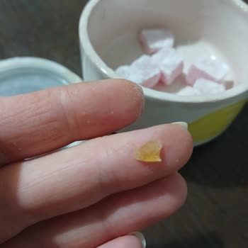 Koska Nazar Boncuklu Lokumda Bulunan Sert Plastik Parça Çocuğumun Dişine Tehdit Oluşturdu