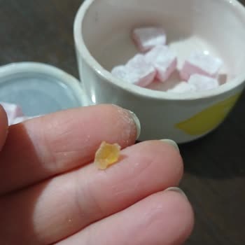 Koska Nazar Boncuklu Lokumda Bulunan Sert Plastik Parça Çocuğumun Dişine Tehdit Oluşturdu