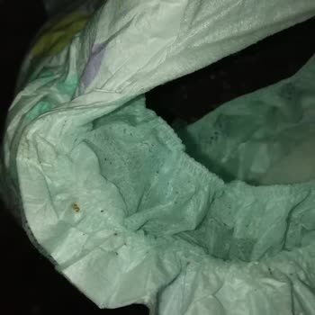 Bebek Bezinde Kurt Ve Larvalar: Sağlık Riski Ve Acil İnceleme Talebi