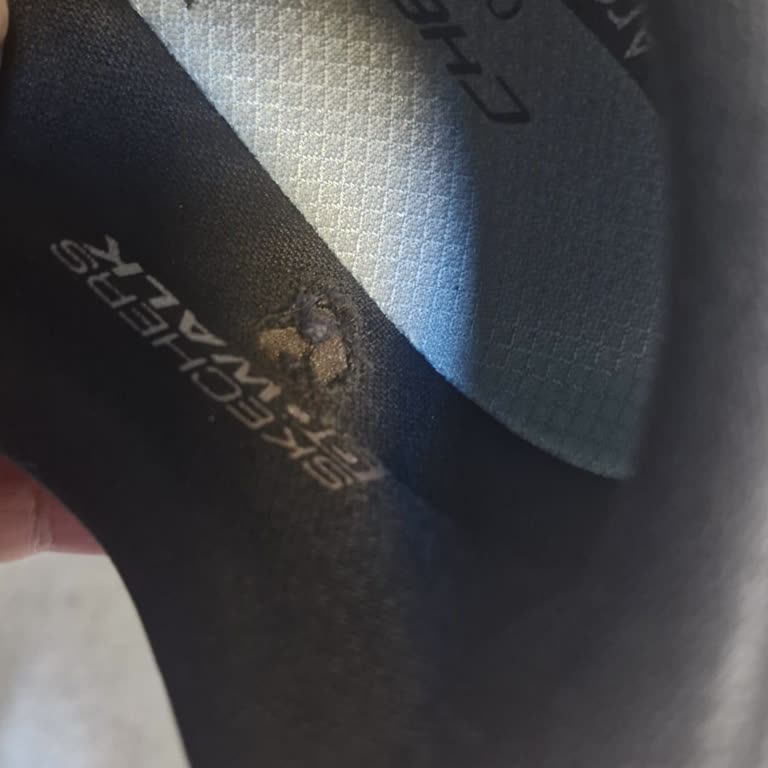 Kısa Sürede Yırtılan Ayakkabı Tabanı İçin Yasal Haklarımı Kullanacağım