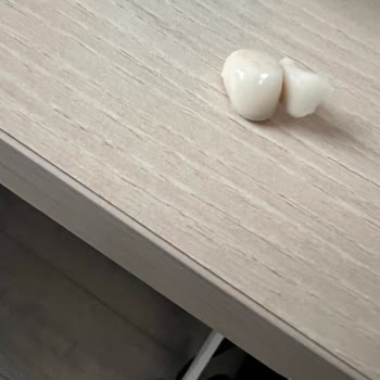 Aydınlatılmış Onam Alınmadan Diş Çekimi Ve Hasta Hakları İhlali