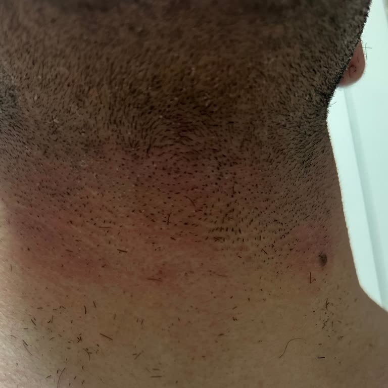 Cildi Tahriş Eden Powertec Tıraş Makinesinin İade Reddi