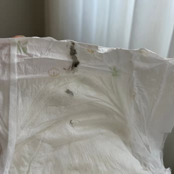 Bebek Bezinde Siyah Tüy Topakları Ve Eksik Üretim Bilgileri Nedeniyle Güven Sorunu