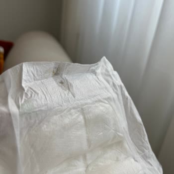 Bebek Bezinde Siyah Tüy Topakları Ve Eksik Üretim Bilgileri Nedeniyle Güven Sorunu