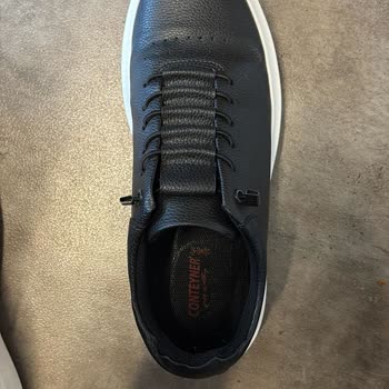 Ayakkabıların Ayağa Zarar Vermesi Ve İade/Değişim Reddi