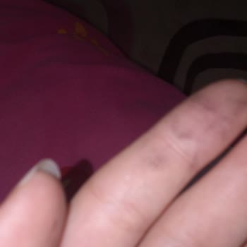 Koton'dan Gelen Hırka Yağlı Çıktı, İade İmkânsızlığı