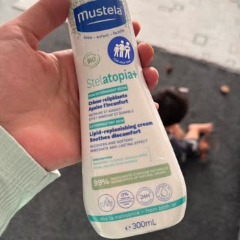 Bebekte Şiddetli Kaşıntı Ve Alerjik Reaksiyon Yaratan Mustela Stelatopia Ürünü