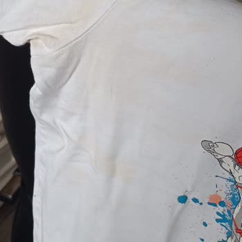 Maman Roll-On Ürünü Kıyafetlerimde Kalıcı Lekeler Ve 8 Bin TL Maddi Zarar