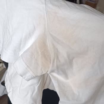 Maman Roll-On Ürünü Kıyafetlerimde Kalıcı Lekeler Ve 8 Bin TL Maddi Zarar