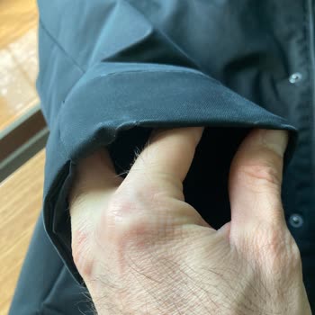 Montumdaki Kol Uçlarındaki Yıpranma Üç Kez İncelendi Ve Hepsi Kullanıcı Hatası Olarak Reddedildi