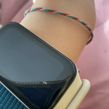 Xiaomi Mi Band 2 Ekran Çizik Garanti Kapsamında Değişim Talebi