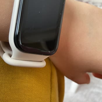 Xiaomi Mi Band 2 Ekran Çizik Garanti Kapsamında Değişim Talebi