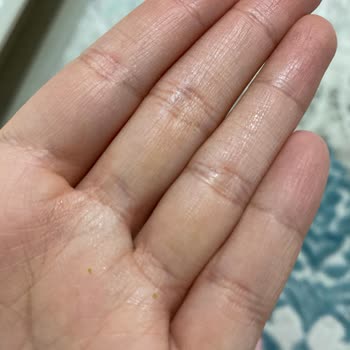 Kedimde İshal Ve Diş Etleri Kararmasına Neden Olan Bayat Royal Canin Mama İçin İade Reddi