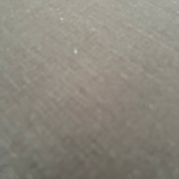 İstikbal Koltuk Takımının Keten Kumaşında Tomurcuk Sorunu Ve Çözüm Talebi