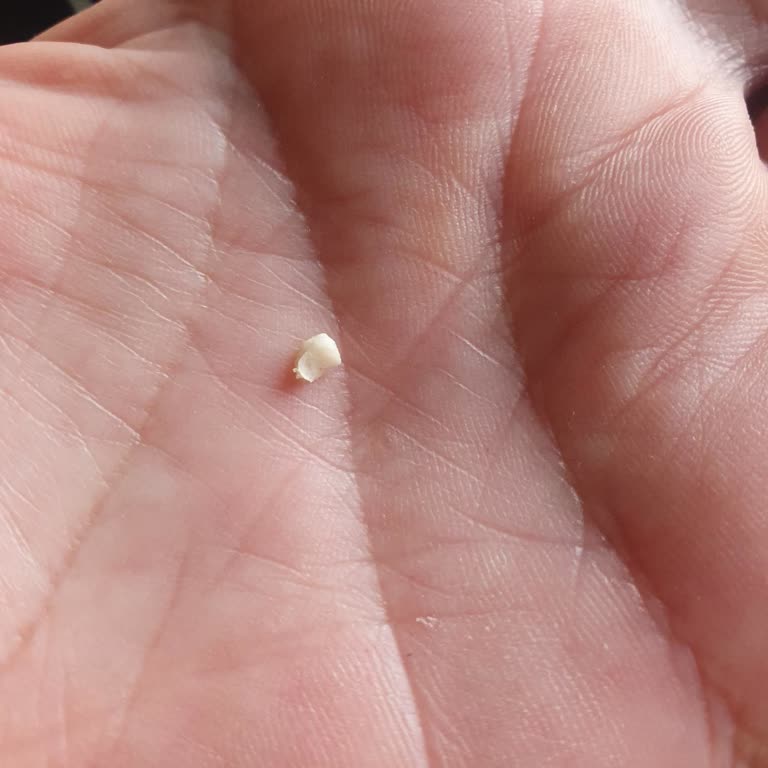 Sıcak Sıcak Mantıyı Yerken İç Harcının İçinden Kemik Parçası Çıktı