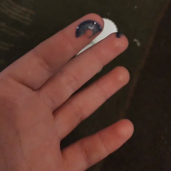 Kalitesiz Lensler Göz Yanması Ve Şişkinliğe Neden Oldu, Firma İletişimsiz