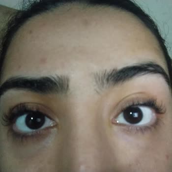 Kirpik Lifting İşlemi Sonrası Kirpiklerim Yanmış Ve Dökülmeye Başladı