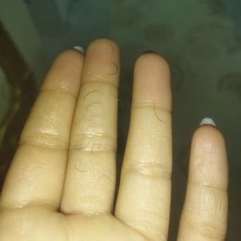 Kirpik Lifting İşlemi Sonrası Kirpiklerim Yanmış Ve Dökülmeye Başladı