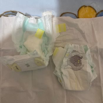 Sol Taraf Kulakçıkları Kopan Bebek Bezlerinde Üretim Hatası Ve İade Talebi