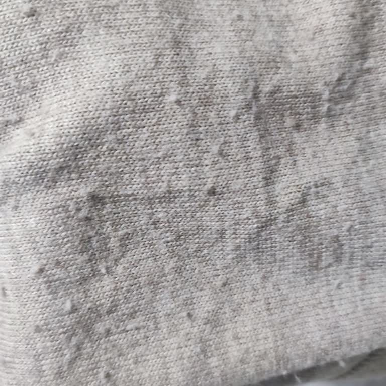 Boyner Fabrika Kazaklarında Kısa Sürede Şekil Bozulması Ve Aşırı Tüylenme İade Talebi