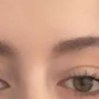 Kaş laminasyonu sonrası iade talebi