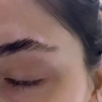 Kaş laminasyonu sonrası iade talebi