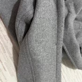 Bershka Ceketinde Hızlı Tüylenme Ve Geri Dönüş Yok