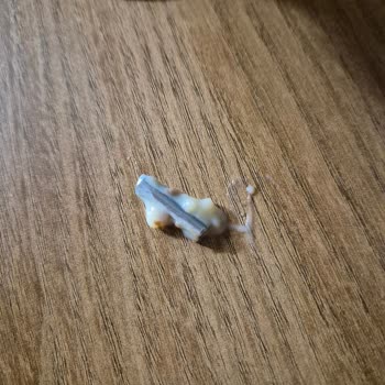 Muzlu Pudinge Karışan Metal Parçası Neredeyse Boğulmaya Ve Diş Ağrısına Neden Oldu