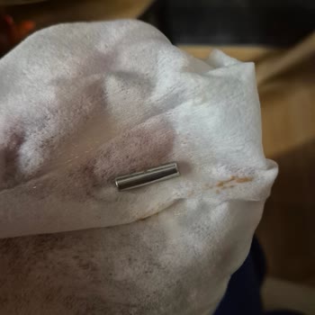 Muzlu Pudinge Karışan Metal Parçası Neredeyse Boğulmaya Ve Diş Ağrısına Neden Oldu