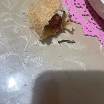 Pınar Dana Sosisinde Çivi Çıktı Diş Dolgularım Kırıldı Ve 8.000 TL Tedavi Masrafı