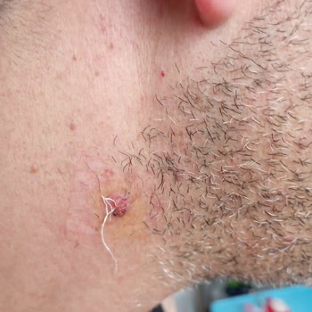 Lazer Aldırma Sözleşmesi İhlali Ve Ödeme İadesi Talebi