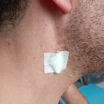 Lazer Aldırma Sözleşmesi İhlali Ve Ödeme İadesi Talebi