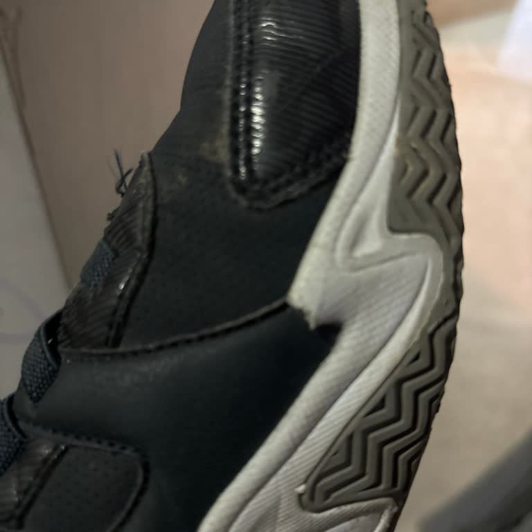 İki Ay Giymediği Skechers Ayakkabısının Yanından Patlaması