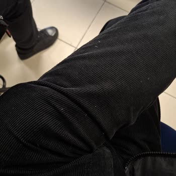 Kaz Tüyü Montum Aşırı Tüy Döküyor, Değişim Talep Ediyorum