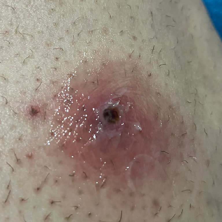 Trendyol Mimosa Care Hem Çok Şaşırdım Hem De Hayal Kırıklığı Yaşadım