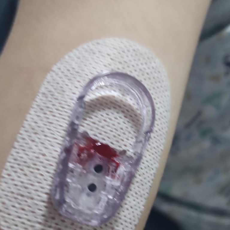 Dexcom G6 Sensörlerinden Çoğu Bozuk Çıktı Ve Değişim Talep Ediyorum