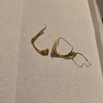 Fasulyedeki Odunumsu Sap Parçaları Hijyen Ve Güven Sorunu