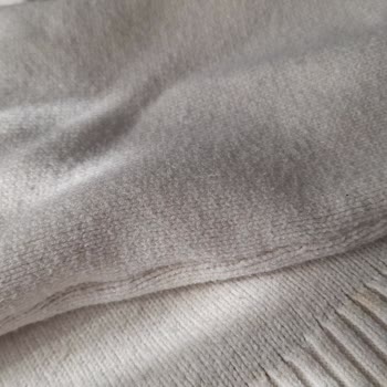 H&M Kazakta Hızlı Tüylenme, Mağaza İade Reddi Ve Müşteri İhmalı