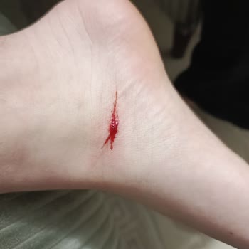 Çocuğumun Ayağını Kesmiş Çiviler Ve Ürün Kalitesi Sorunları