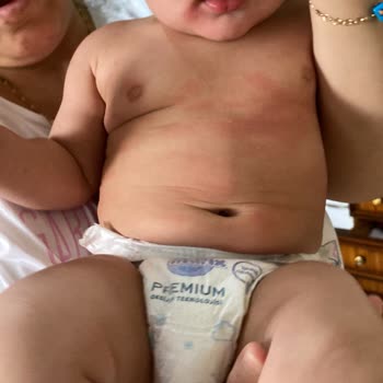 Bebekte Şiddetli Döküntü Ve Kaşıntıya Neden Olan Mustela Stelatopia Ürünleri Geri Çağırılmalı